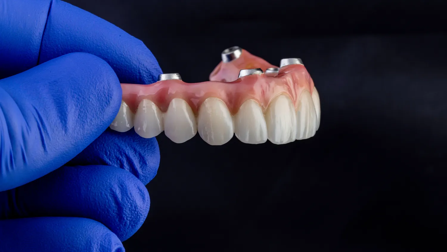 Endodoncja Szczecin