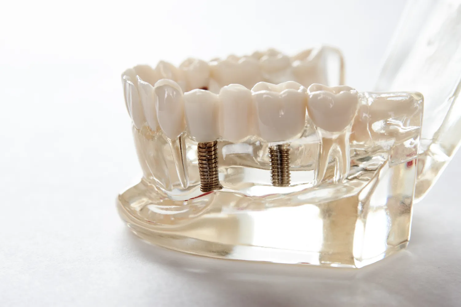 Endodoncja Szczecin