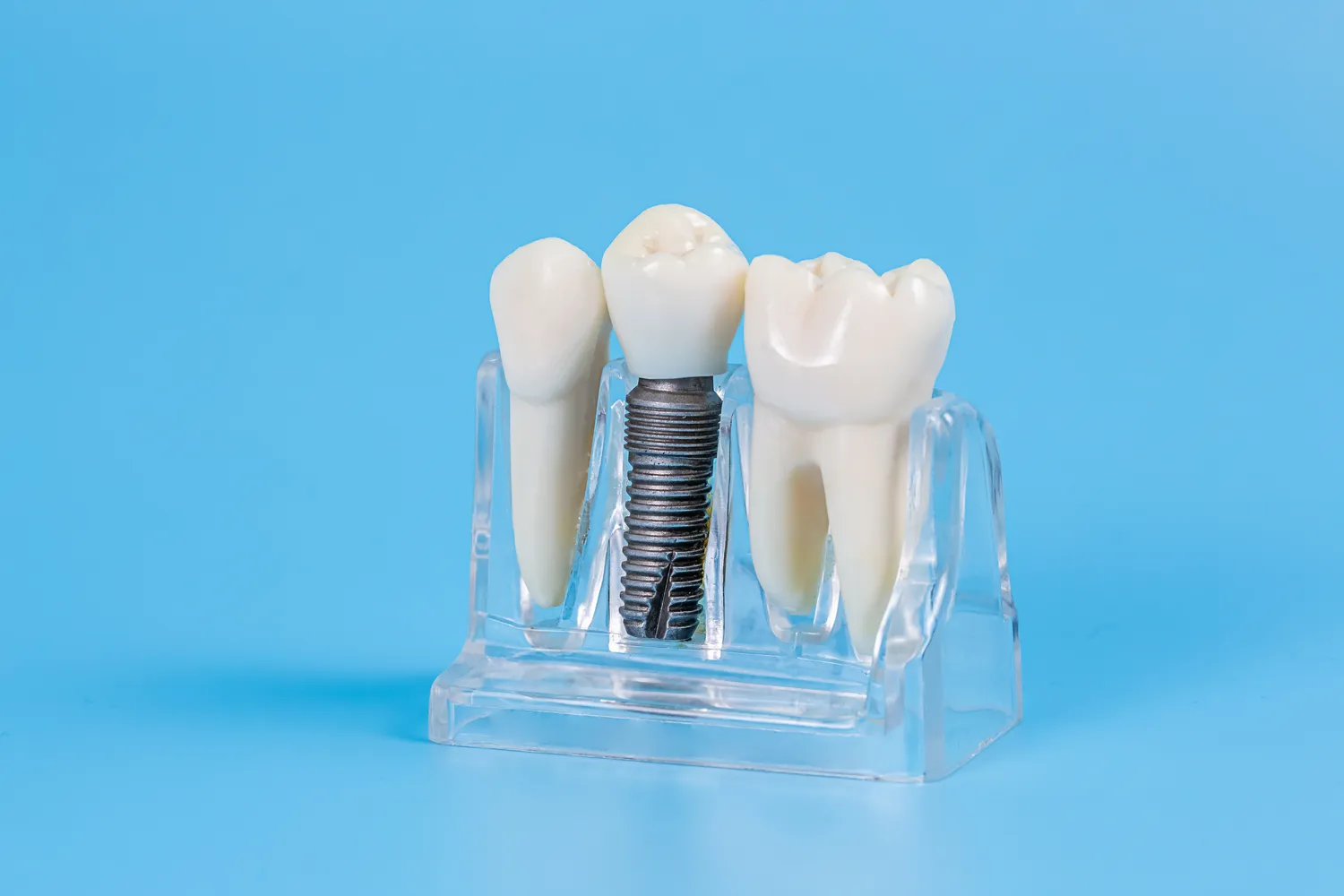 Dzieci u dentysty