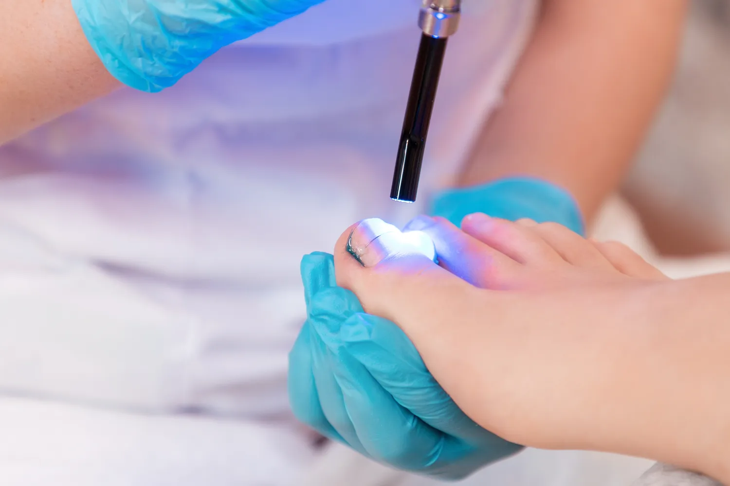 Pedicure leczniczy - co o nim wiedzieć warto?