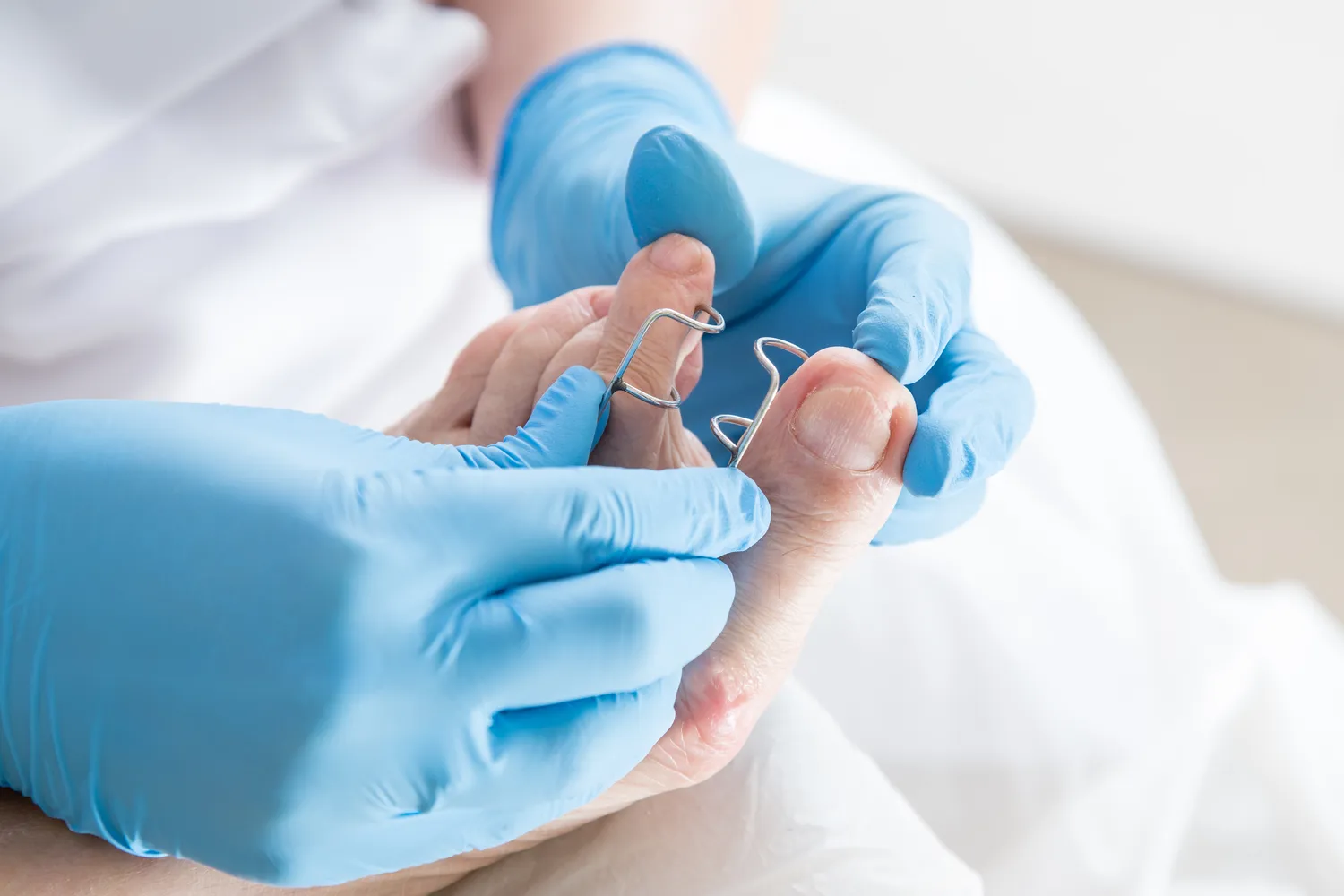 Pedicure podologiczne Szczecin